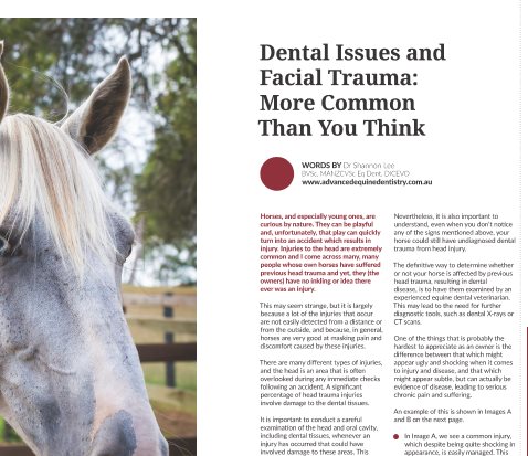 Dental issues and Facial Trauma: More Common Than You Think